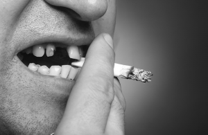impianti dentali nei fumatori