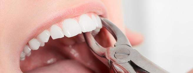 Come Togliere Un Dente Senza Farsi Male